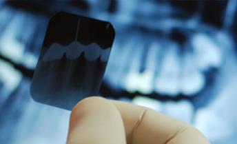 Department Of Oral Medicine & Radiology